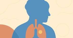 Como tratar a pneumonia nos idosos?