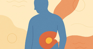 Hérnia inguinal nos idosos: quando consultar um médico